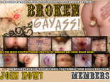 Shocking and exciting broken gay asses pics' collection for lovers of hot ass fuck
